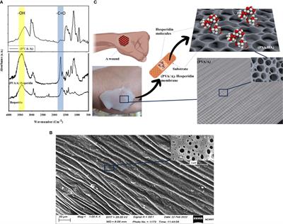 Hesperidin - loaded PVA/alginate hydrogel: targeting NFκB/iNOS/COX-2/TNF-α inflammatory signaling pathway